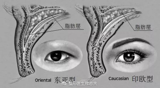 有人说十个开内眼角竟有九个失败的?|内眼角|眼