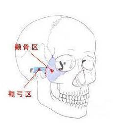 颧弓颧骨