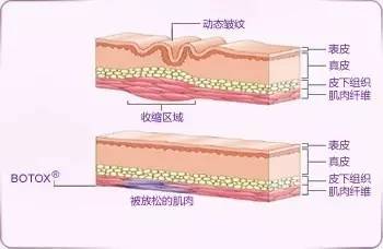 脸型
