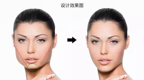 脸型