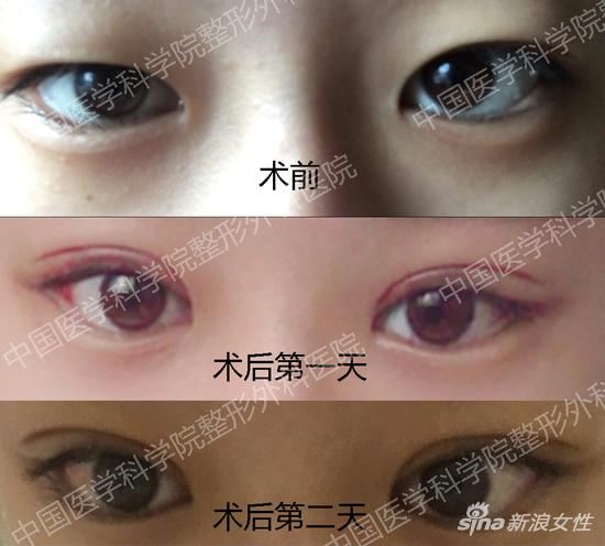 中国医学科学院整形外科案例