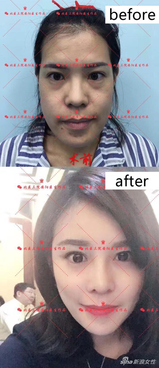 北医三院整形外科