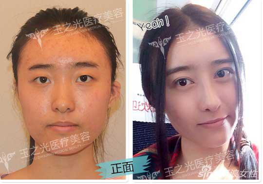 北京玉之光医疗美容门诊部案例