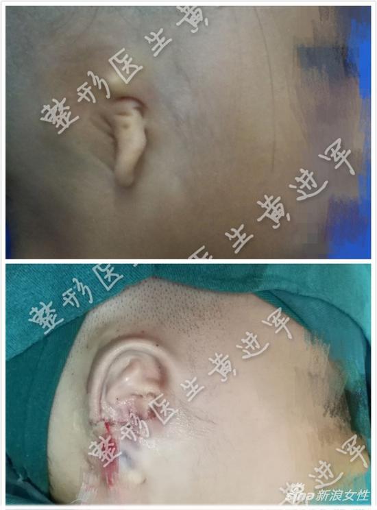 南昌大学第一附属医院整形外科案例