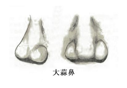 为什么大鼻头是你心里永远的痛?|整形|鼻头|鼻尖_新浪女性_新浪网