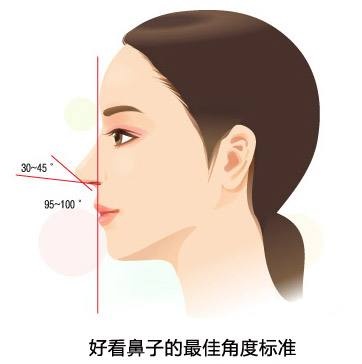 萝莉混血女王你该如何挑鼻型