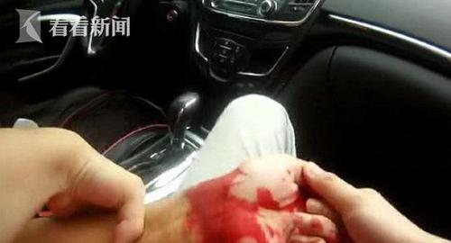 前夫割腕