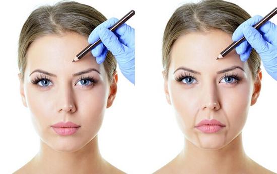 法令纹怎么治它呢?|眼膜|颊骨|笑肌_新浪女性_新浪网