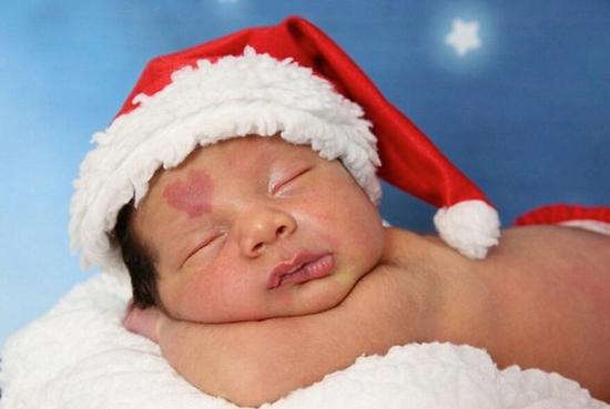 The birthmark was first found by Çinar’s father at the delivery room. When the nurses cleaned the baby’s head, his father saw the spot: “And when I came closer and saw it was a magical little hard, I almost cried. It was amazing.”
