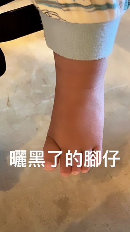 组图:张柏芝边敷面膜边陪小儿子玩 marcus小肉脚被晒黑萌态十足_高清