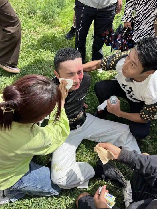 尼格买提录节目面部受伤 撒贝宁协助处理伤口封面图