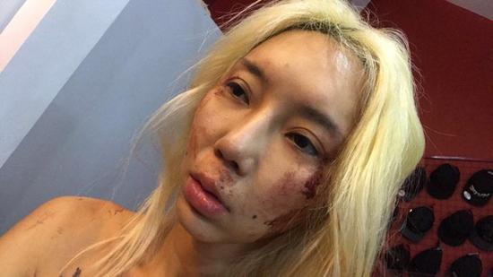 林云这几年来不断被暴打,她透露无法报警是因为男友在警界颇有人脉