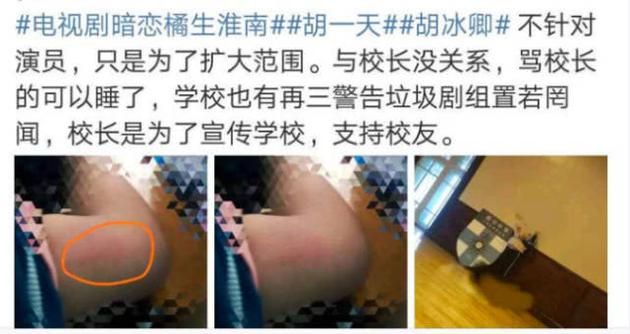 网友晒照称上厕所时被剧组工作人员拖拽,胳膊被掐青。