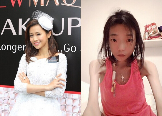 杨爱瑾忍7年小三扶正结婚,男方前妻伍智恒因失婚暴瘦