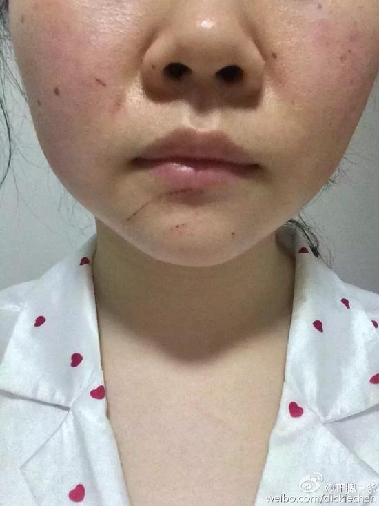 好声音后期制作员工遭捂迷药 歹徒未得逞|好声