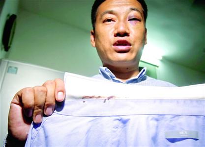 当事人徐先生向记者展示沾有血迹的衬衣　晨报记者 张佳琪