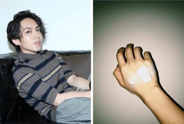 林宥嘉晒出打点滴的照片