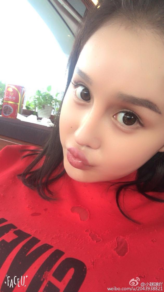 赵本山女儿脸似充气