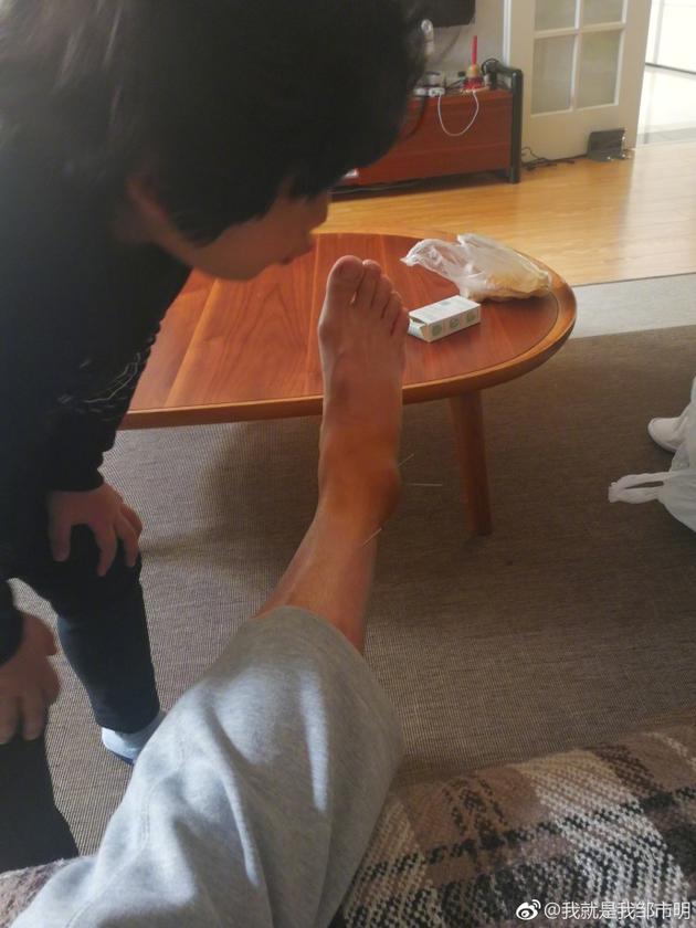 邹市明微博晒针灸近照