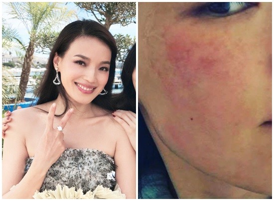 舒淇出席坎城影展时,脸上看不出有过敏。