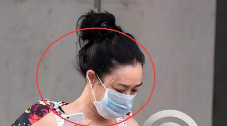 钟丽缇