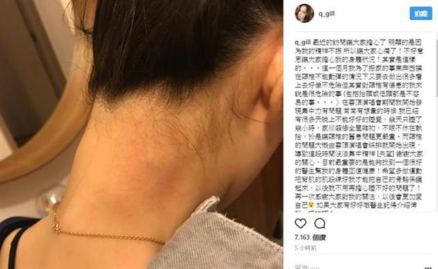 阿娇被指言行反常眼神涣散 发文谈原因感谢关心（图） - 2