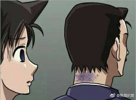 小五郎的脖子上一片青紫