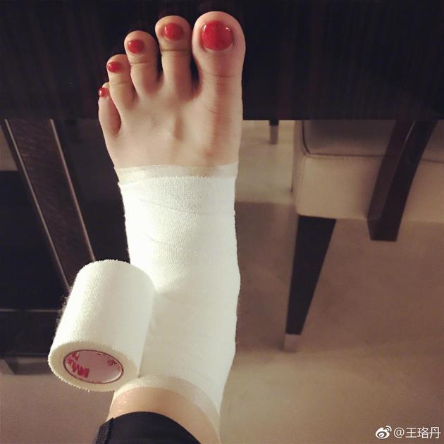 王珞丹脚伤照被趾甲抢镜 网友:脚趾好像在咧嘴笑