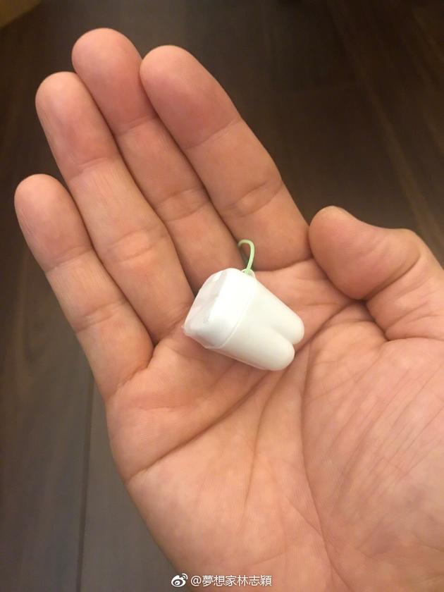 林志颖晒儿子乳牙照 只是这颗牙看着有点大|