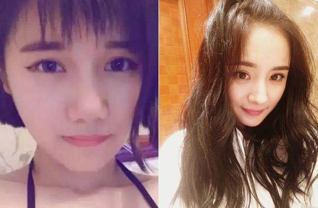 粉丝照着杨幂整容狂砸百万 嘴唇都肿成香肠嘴还誓不罢休