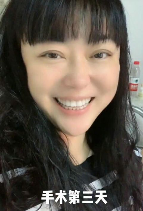 演员李菁菁自曝患乳腺癌 术后面容消瘦明显