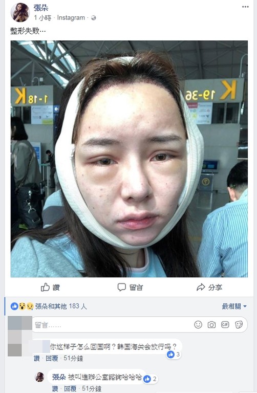 台网红Kiwebaby整容失败