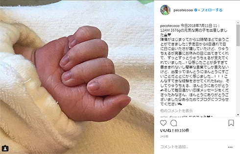 龙切尔Peco宣布第一子出生 不到一小时获10万点赞
