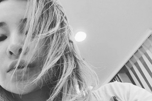 萧亚轩晒自拍照脸部疤痕变浅