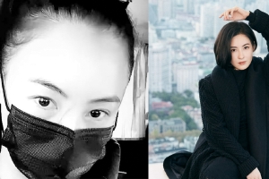 张柏芝晒鼻梁附近的超长伤疤