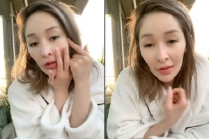 萧亚轩素颜开直播公开右脸伤疤