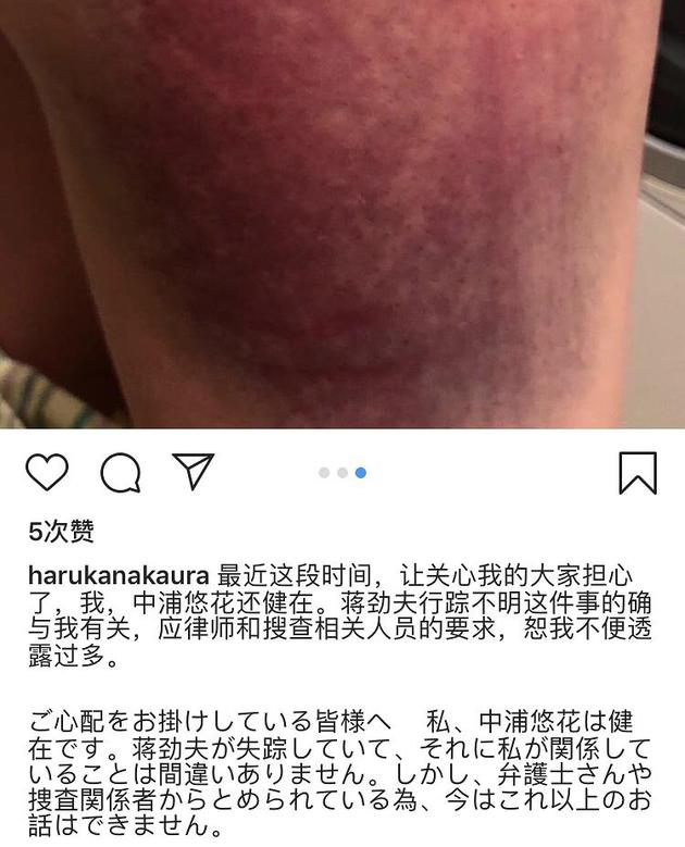 律师解读蒋劲夫案:家暴成立?10亿日元赔偿真假?