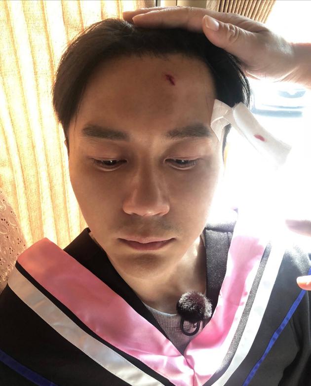 李晨被砸伤
