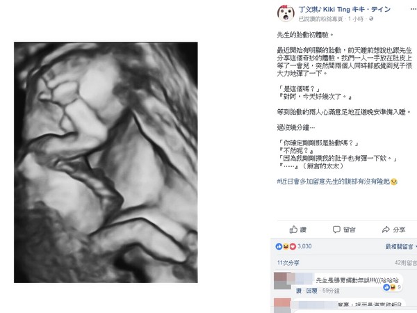 丁文琪晒出宝宝超声波照，还泄漏了林宥嘉的“胎动初体验”