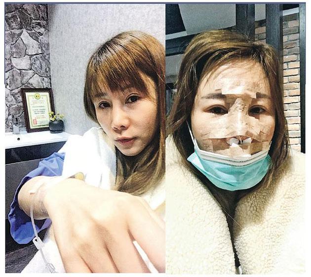 艾美琦前往台湾做整容手术遇到地震,幸好有惊无险。