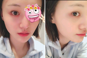 眼睛受伤也很美！郑爽晒纯素颜照大眼水灵