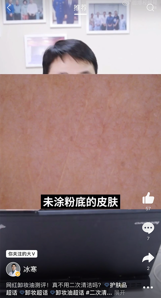 未涂抹粉底的肌肤表面 图片来源:@冰寒 微博视频截图