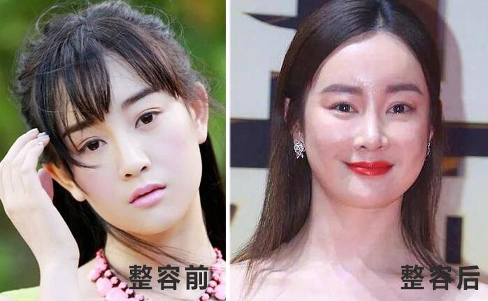 演员张檬