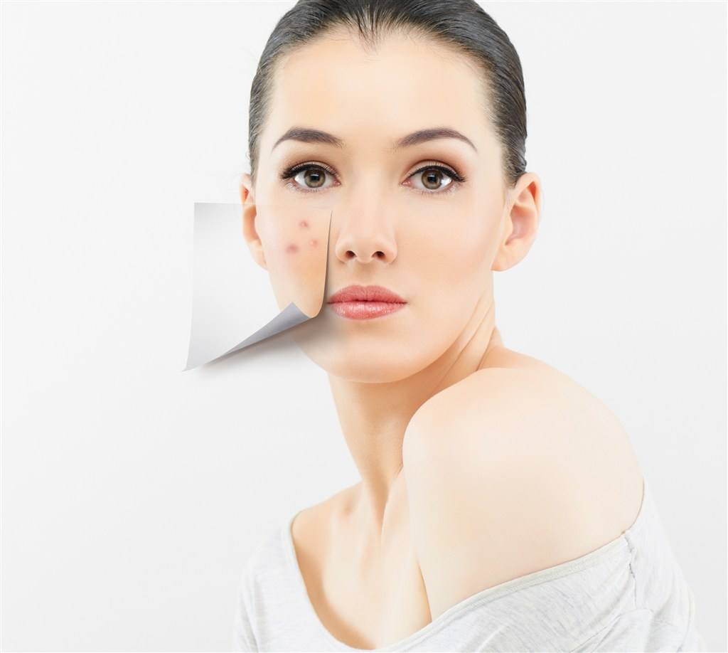 祛痘印痘坑方法 痘痘肌护理全攻略