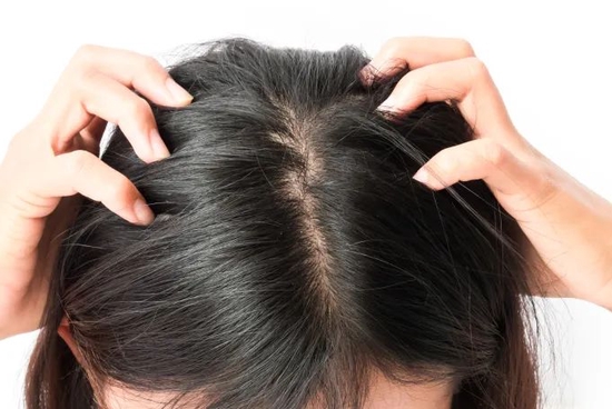 怎么拥有健康的头皮 9c1a-cf2c72b165a9add5a5ce1e9f6413ec56.jpg