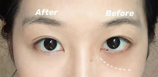 保姆级遮瑕大法 全网都在求-幽兰花香 保姆级遮瑕大法 全网都在求-幽兰花香