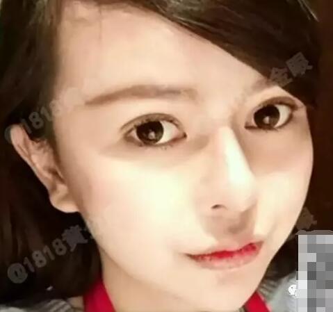 小田是贵州人,两个月前来杭州找了家整容门诊做手术,这段时间一直都在恢复。前天凌晨发生的一件事,让小田到现在都不敢照镜子。