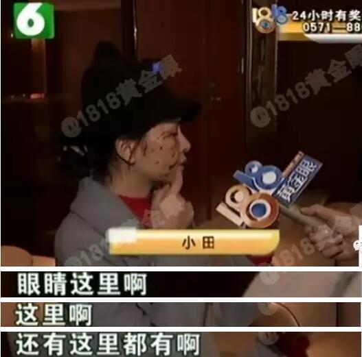 双方都做了整形,现在的脸都抓伤了。
