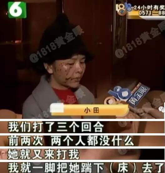 现在,小田已经不同于相片中的模样,右脸多处伤口,下巴,额头也被抓伤。