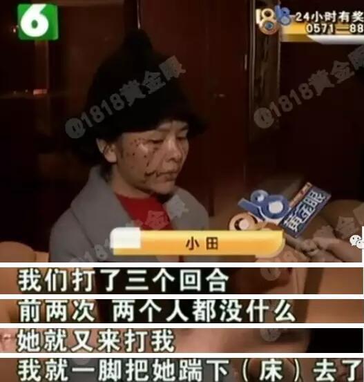 现在，小田已经不同于相片中的模样，右脸多处伤口，下巴，额头也被抓伤。  